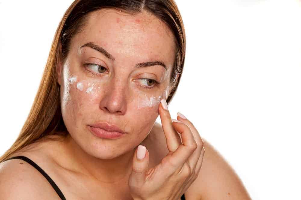 Guide to Age Spot Removers