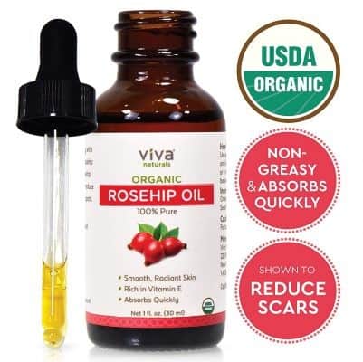 Best for Sensitive Skin: Viva Naturals Rosehip Oil