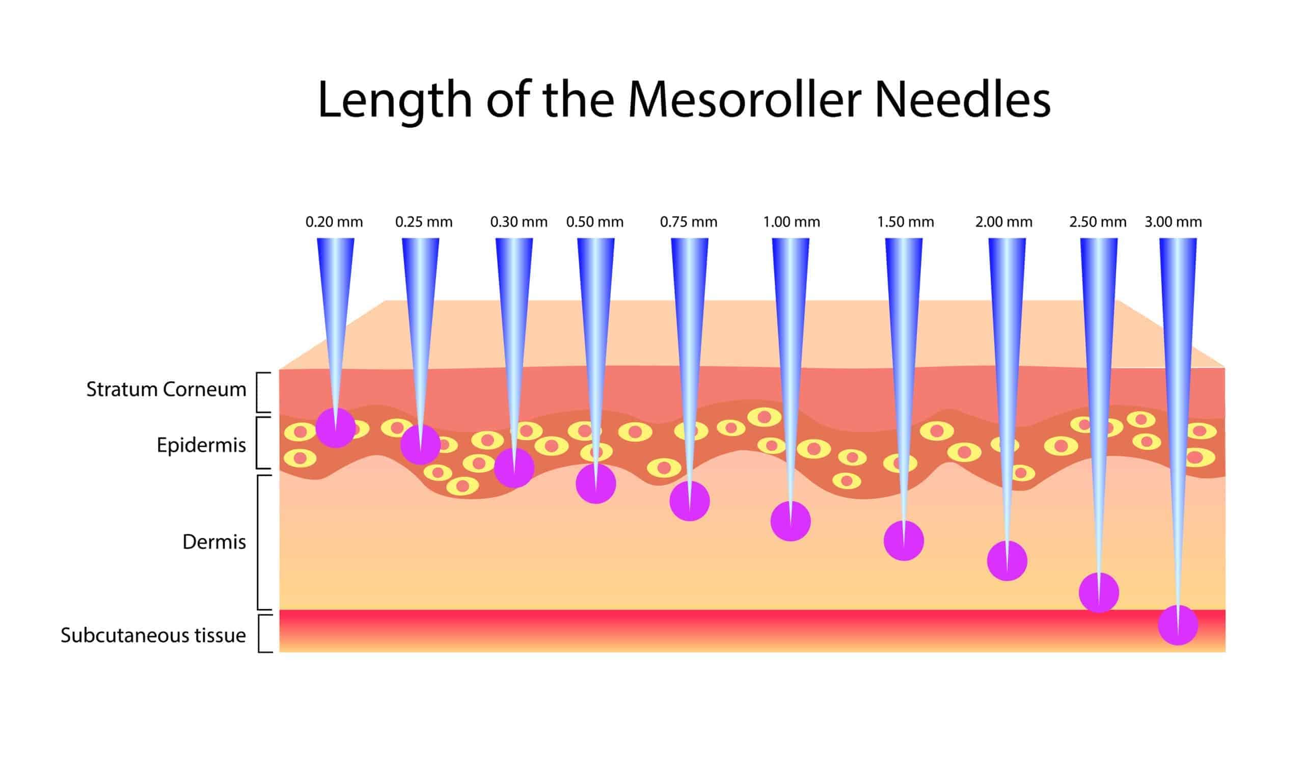 What Is Derma Rolling Good For?