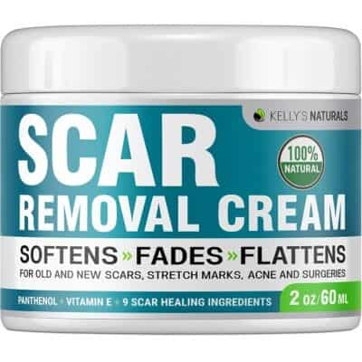 Best for Old Stretch Marks: Kelly’s Naturals Scar Removal Cream